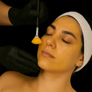 6. MG Beauty Clinic - Immagini Sito Shop - Peeling - Yellow Peeling