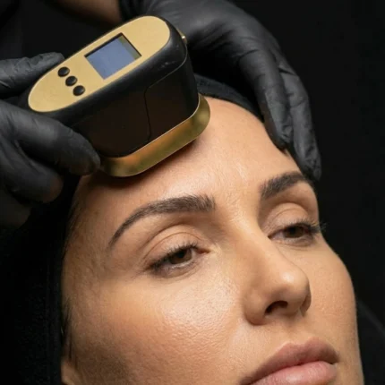 HIFU Fronte - MG Beauty Clinic - Immagini sito shop