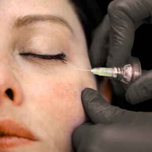 MG Beauty Clinic - Immagini sito shop - Carbossiterapia Viso