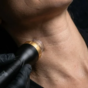 Radiofrequenza Collo - MG Beauty Clinic - Immagini sito shop