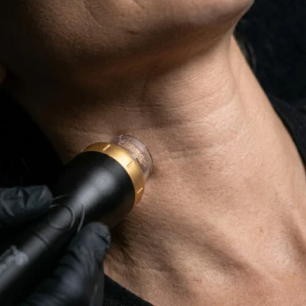 Radiofrequenza Collo - MG Beauty Clinic - Immagini sito shop