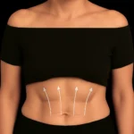 15. MG Beauty Clinic - Immagini Sito Shop - Fili di Biostimolazione