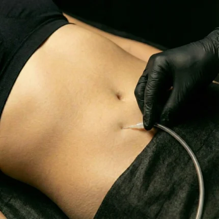 MG Beauty Clinic - Immagini Shop - Carbossiterapia Addome