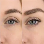 MG Beauty Clinic - Immagini Sito Shop - CANTOPESSI (2)