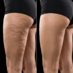 MG Beauty Clinic - Immagini Sito Shop - CELLFINA (2)