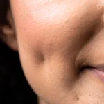 MG Beauty Clinic - Immagini Sito Shop - Dimeplasty