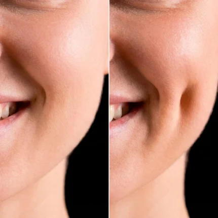 MG Beauty Clinic - Immagini Sito Shop - Dimeplasty (2)