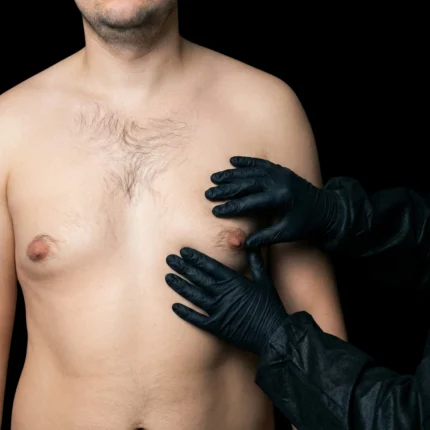 MG Beauty Clinic - Immagini Sito Shop - GINECOMASTIA