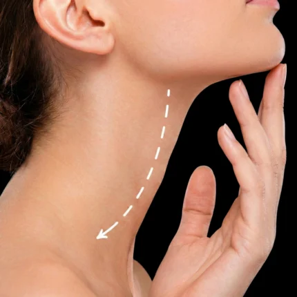 MG Beauty Clinic - Immagini Sito Shop - Lifting collo