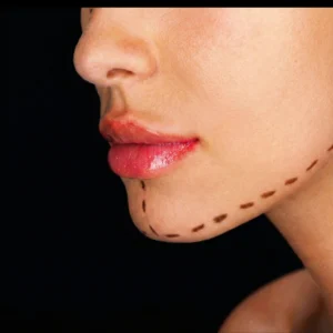 MG Beauty Clinic - Immagini Sito Shop - MENTOPLASTICA