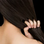 MG Beauty Clinic - Immagini Sito Shop - MESOTERAPIA CUOIO CAPELLUTO