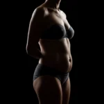 MG Beauty Clinic - Immagini Sito Shop - Mommy Makeover