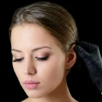 MG Beauty Clinic - Immagini Sito Shop - OTOPLASTICA