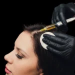 MG Beauty Clinic - Immagini Sito Shop - PRP CUOIO CAPELLUTO