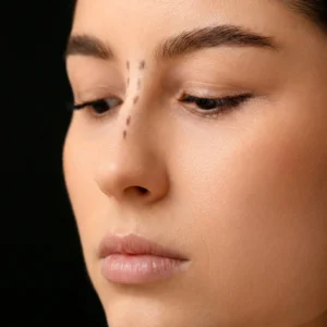 MG Beauty Clinic - Immagini Sito Shop - RINOPLASTICA