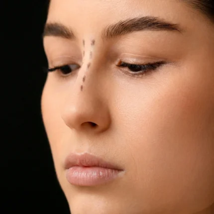 MG Beauty Clinic - Immagini Sito Shop - RINOPLASTICA