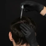 MG Beauty Clinic - Immagini Sito Shop - TRATTAMENTI STIMOLANTI ANTICADUTA