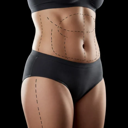 MG Beauty Clinic - Immagini Sito Shop - Vaser Lipo HD