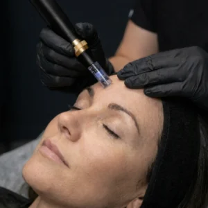 MG Beauty Clinic - Immagini sito shop - Dermapen (2)