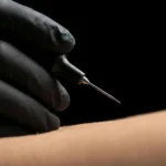 MG Beauty Clinic - Immagini Sito Shop - Elettrocoagulazione