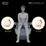 MG Beauty Clinic - Immagini Sito Shop - Emsella (4)