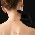 MG Beauty Clinic - Immagini Sito Shop - Shaving