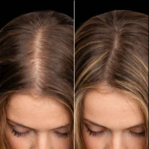 MG Beauty Clinic - Immagini Sito Shop - HAIR FILLER (2)