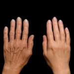 15. MG Beauty Clinic - Immagini Sito Shop - Filler Mani