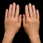 16. MG Beauty Clinic - Immagini Sito Shop - Filler Mani