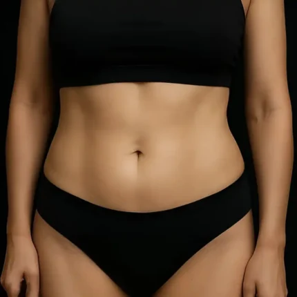 3. MG Beauty Clinic - Immagini Sito Shop - Riduzione del Grasso - Lipodissolve