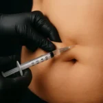 5. MG Beauty Clinic - Immagini Sito Shop - Riduzione del Grasso - Intralipoterapia