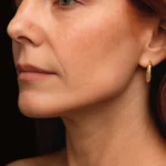 8. MG-Beauty Clinic Laser CO₂ Resurfacing Viso + Collo Singola Seduta