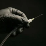 MG Beauty Clinic - Immagini Shop - Carbossiterapia Generale