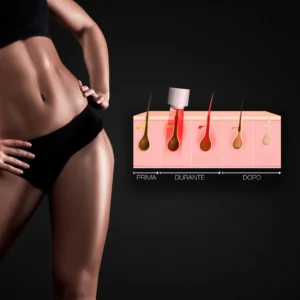 MG Beauty Clinic - Immagini Sito Shop - Epilazione Donna