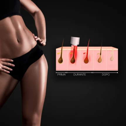 MG Beauty Clinic - Immagini Sito Shop - Epilazione Donna