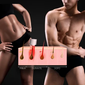 MG Beauty Clinic - Immagini Sito Shop - Epilazione Donna e Uomo