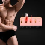 MG Beauty Clinic - Immagini Sito Shop - Epilazione Uomo