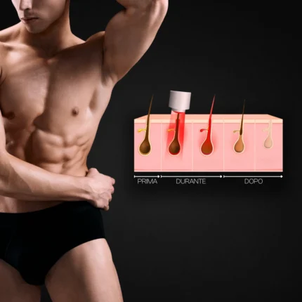 MG Beauty Clinic - Immagini Sito Shop - Epilazione Uomo