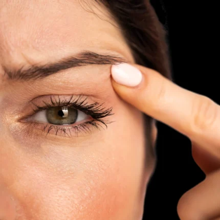 MG Beauty Clinic - Immagini sito shop - Blefaroplastica Soft