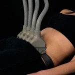 MG Beauty Clinic - Immagini sito shop - Laser Shape Addome