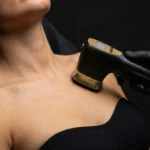 HIFU Décolleté - MG Beauty Clinic - Immagini sito shop