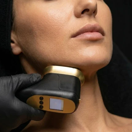 HIFU Sottomento - MG Beauty Clinic - Immagini sito shop