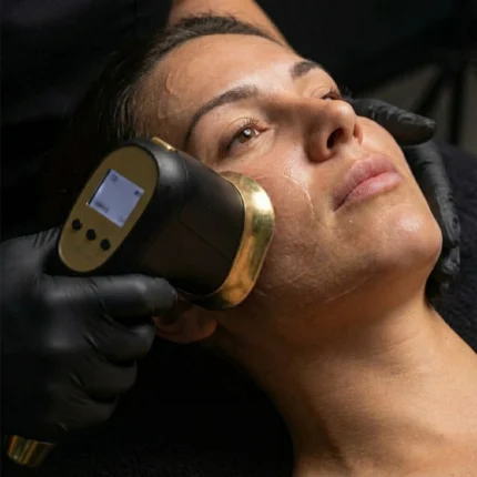 HIFU Viso Completo - MG Beauty Clinic - Immagini sito shop