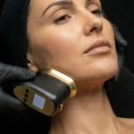 HIFU Viso Inferiore - MG Beauty Clinic - Immagini sito shop