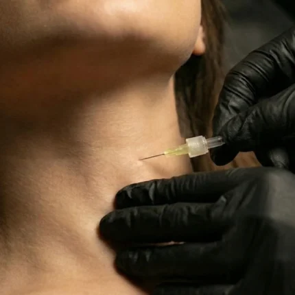 MG Beauty Clinic - Immagini Shop - Carbossiterapia Collo