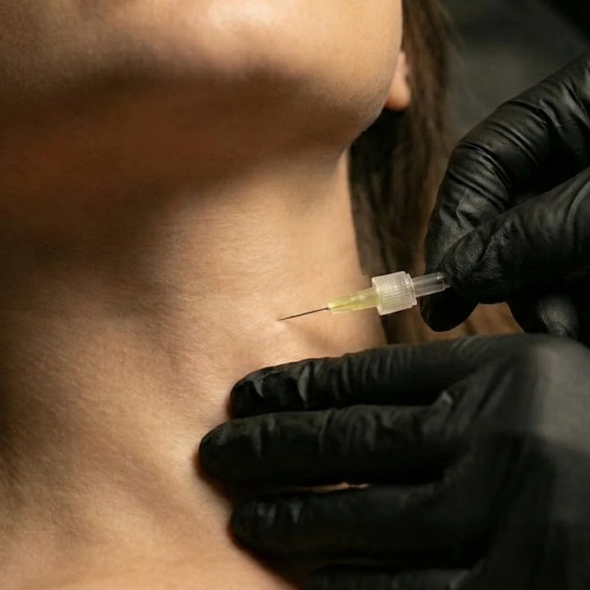 MG Beauty Clinic - Immagini Shop - Carbossiterapia Collo MG Beauty Clinic - Immagini Shop - Carbossiterapia Collo