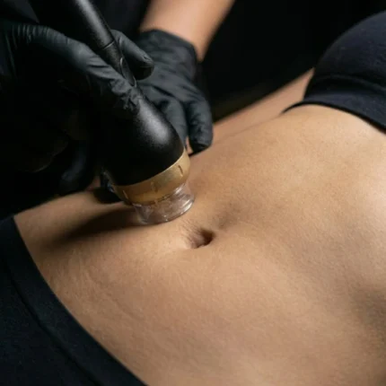 Radiofrequenza Addome - MG Beauty Clinic - Immagini sito shop