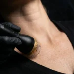 Radiofrequenza Decollete - MG Beauty Clinic - Immagini sito shop