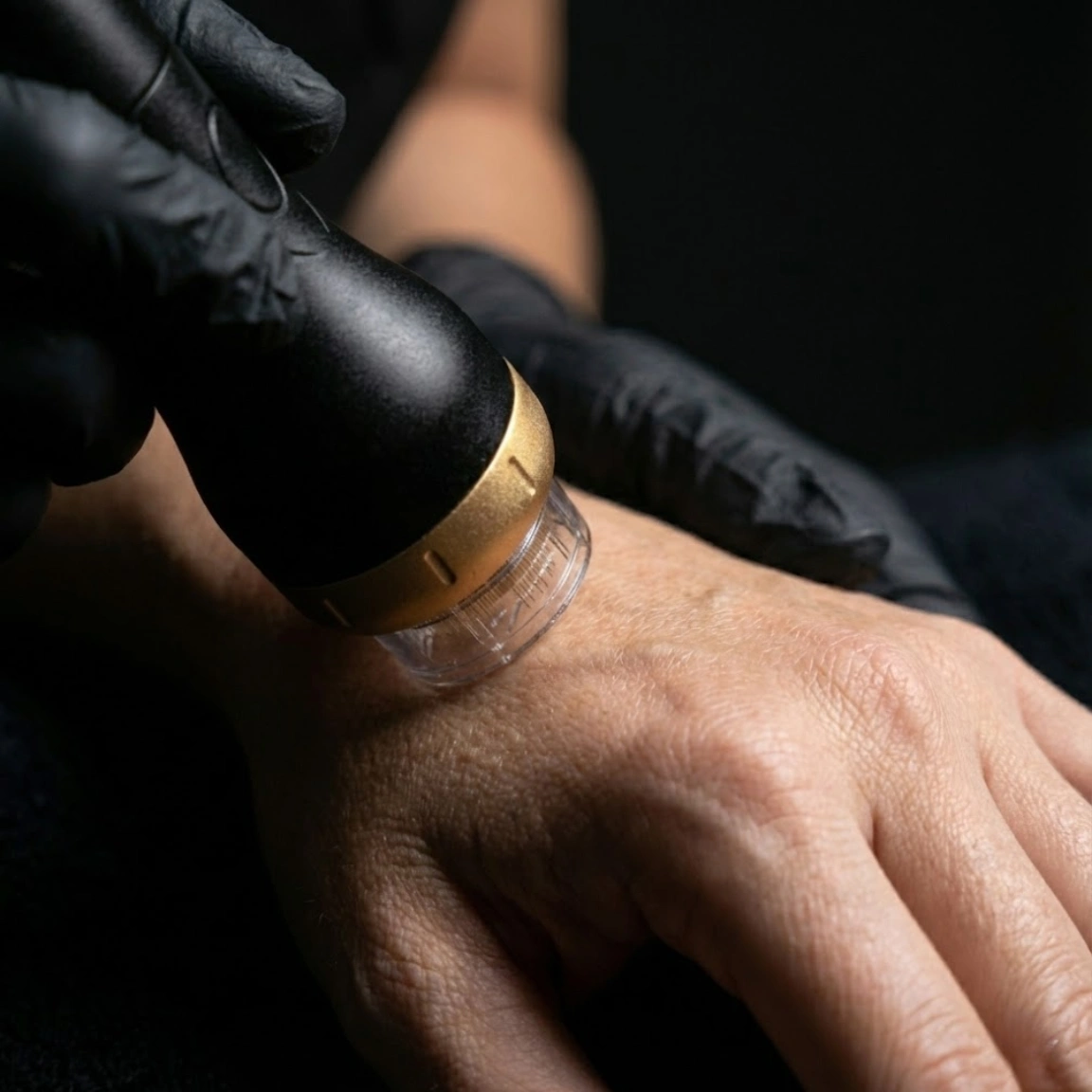 Radiofrequenza Mani - MG Beauty Clinic - Immagini sito shop Radiofrequenza Mani - MG Beauty Clinic - Immagini sito shop