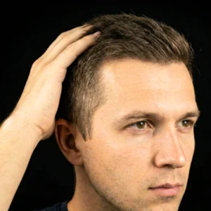 MG Beauty Clinic - Immagini Sito Shop - Bioristrutturazione Cuoio Capelluto (2)